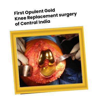 First Opulent Gold Knee Replacement Surgery of Central India