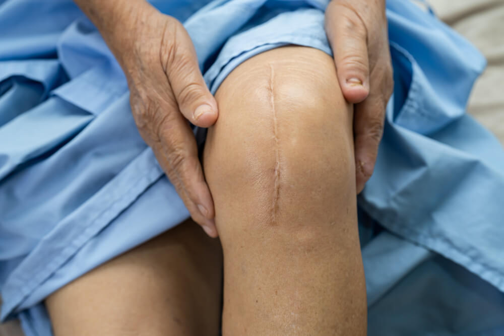 Knee Replacement Surgeon in Indore