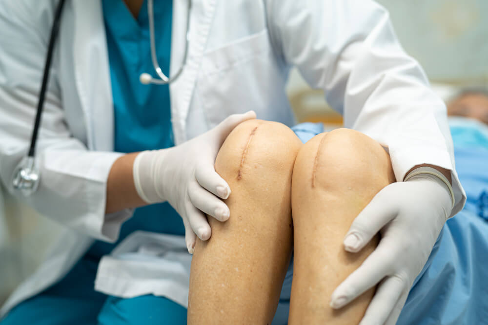 India’s Best Knee Replacement Surgeons: How Dr. Sunil Rajan is Changing Lives