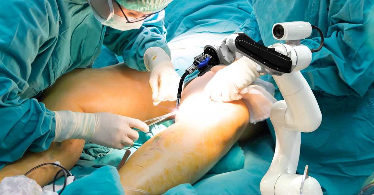 Latest Advances in Joint Replacement Surgery in 2025