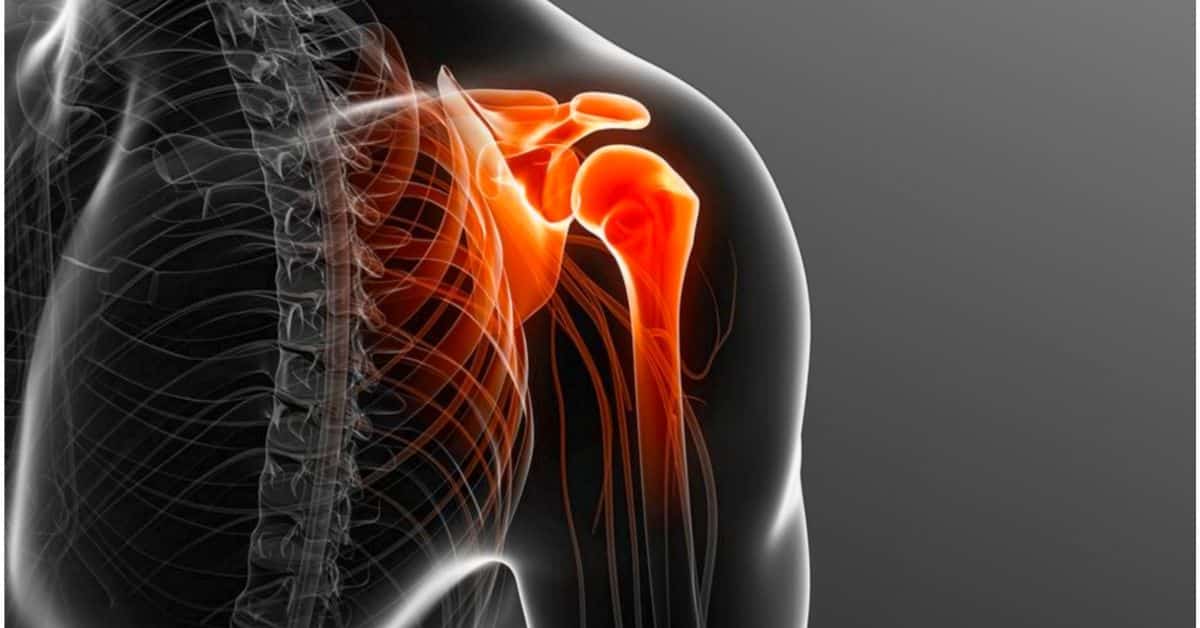 Say Goodbye to Shoulder Pain with Total Shoulder Replacement